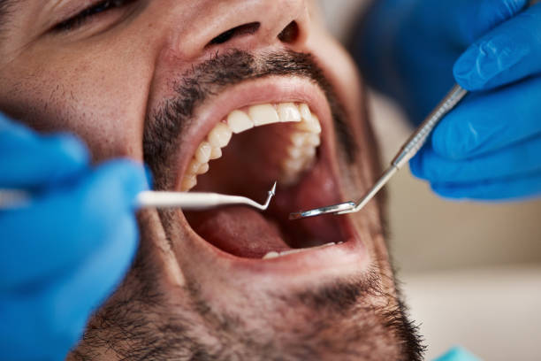 Best Emergency Orthodontic Repairs in Linden, TX